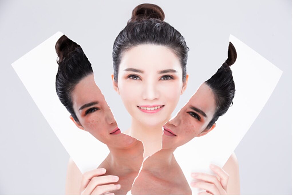 美白