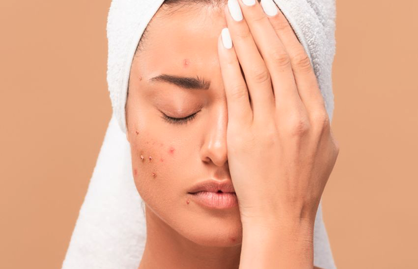 2026女性關鍵營養研究：「葡萄糖酸鋅」從根源改善落髮與痘痘危機